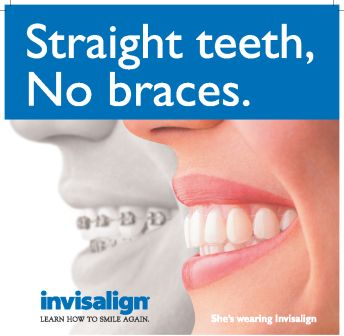 auckland-Invisalign-braces