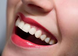 epsom dentists teeth whitening