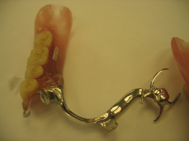 Dentures Auckland Dentists