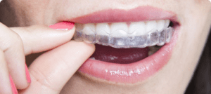 invisalign teeth straightening braces