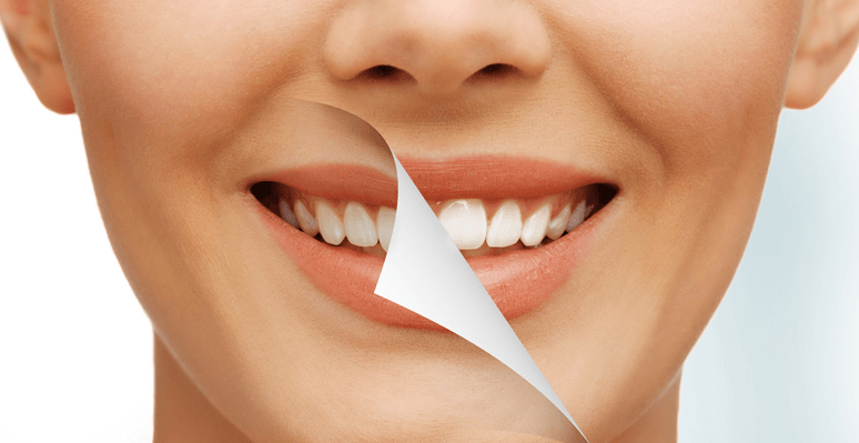 Cosmetic Dentistry Auckland Dentists