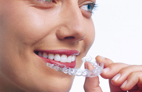 Invisalign After Treatment